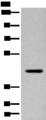 FAM105A Antibody - Western blot analysis of Human placenta tissue lysate  using FAM105A Polyclonal Antibody at dilution of 1:400