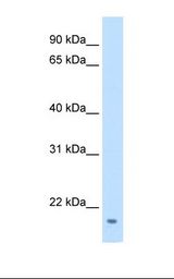 FAM107A / TU3A Antibody - Transfected 293T cell lysate. Antibody concentration: 0.0625 ug/ml. Gel concentration: 15%.  This image was taken for the unconjugated form of this product. Other forms have not been tested.