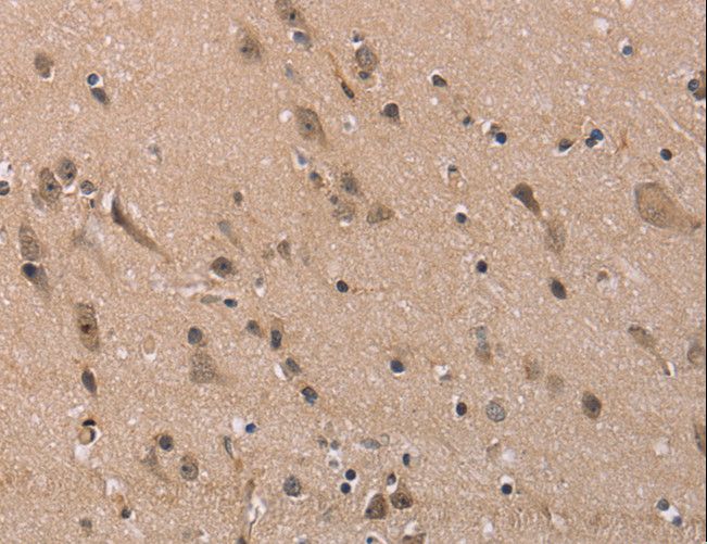 FAM107A / TU3A Antibody - Immunohistochemistry of paraffin-embedded Human brain using FAM107A Polyclonal Antibody at dilution of 1:30.