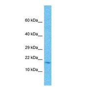 FAM107A / TU3A Antibody - Western blot of Human large intestine Tumor. FAM107A antibody dilution 1.0 ug/ml.  This image was taken for the unconjugated form of this product. Other forms have not been tested.
