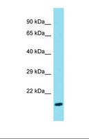 FAM107B Antibody - Western blot of Rat Lung. Fam107b antibody dilution 1.0 ug/ml.  This image was taken for the unconjugated form of this product. Other forms have not been tested.