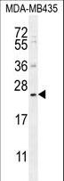 FAM109A Antibody - FAM109A Antibody western blot of MDA-MB435 cell line lysates (35 ug/lane). The FAM109A antibody detected the FAM109A protein (arrow).