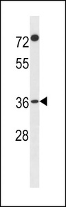 FAM110A Antibody - F110A Antibody western blot of A2058 cell line lysates (35 ug/lane). The F110A antibody detected the F110A protein (arrow).