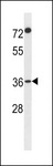 FAM110A Antibody - F110A Antibody western blot of A2058 cell line lysates (35 ug/lane). The F110A antibody detected the F110A protein (arrow).