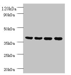 FAM110B / C8orf72 Antibody - Western blot All lanes: Prootein FAM110B antibody at 2µg/ml Lane 1: Mouse sexual gland tissue Lane 2: HepG2 whole cell lysate Lane 3: Mouse spleen tissue Lane 4: A431 whole cell lysate Secondary Goat polyclonal to rabbit IgG at 1/10000 dilution Predicted band size: 41 kDa Observed band size: 41 kDa