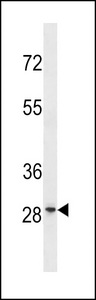 FAM110D / GRRP1 Antibody - GRRP1 Antibody western blot of HL-60 cell line lysates (35 ug/lane). The GRRP1 antibody detected the GRRP1 protein (arrow).