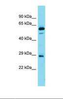 FAM110D / GRRP1 Antibody - Western blot of Human Fetal Brain. FAM110D antibody dilution 1.0 ug/ml.  This image was taken for the unconjugated form of this product. Other forms have not been tested.