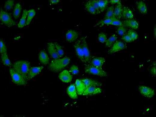 FAM111A Antibody - Immunofluorescent analysis of HepG2 cells using FAM111A Antibody at a dilution of 1:100 and Alexa Fluor 488-congugated AffiniPure Goat Anti-Rabbit IgG(H+L)