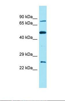 FAM111B Antibody - Western blot of 293T. FAM111B antibody dilution 1.0 ug/ml.  This image was taken for the unconjugated form of this product. Other forms have not been tested.