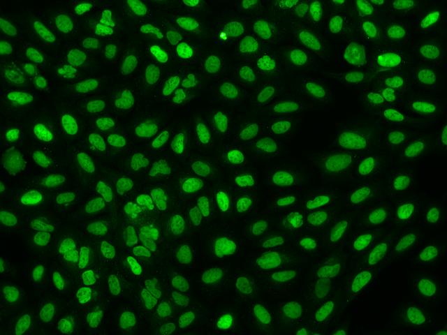 FAM111B Antibody - Immunofluorescence staining of FAM111B in U2OS cells. Cells were fixed with 4% PFA, permeabilzed with 0.1% Triton X-100 in PBS, blocked with 10% serum, and incubated with rabbit anti-Human FAM111B polyclonal antibody (dilution ratio 1:200) at 4°C overnight. Then cells were stained with the Alexa Fluor 488-conjugated Goat Anti-rabbit IgG secondary antibody (green). Positive staining was localized to Nucleus.