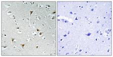 FAM111B Antibody - Peptide - + Immunohistochemistry analysis of paraffin-embedded human brain tissue, using F111B antibody.