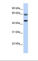 FAM113A Antibody - Fetal muscle lysate. Antibody concentration: 1.0 ug/ml. Gel concentration: 12%.  This image was taken for the unconjugated form of this product. Other forms have not been tested.