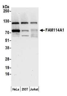 FAM114A1 / Noxp20 Antibody - Detection of human FAM114A1 by western blot. Samples: Whole cell lysate (15 µg) from HeLa, HEK293T, and Jurkat cells prepared using NETN lysis buffer. Antibody: Affinity purified rabbit anti-FAM114A1 antibody used for WB at 1:1000. Detection: Chemiluminescence with an exposure time of 30 seconds.