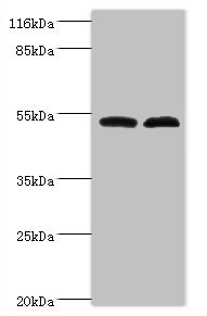 Fam114a2 Antibody - Western blot All lanes: Protein FAM114A2 antibody at 2µg/ml Lane 1: Mouse kidney tissue Lane 2: U251 whole cell lysate Secondary Goat polyclonal to rabbit IgG at 1/10000 dilution Predicted band size: 55 kDa Observed band size: 55 kDa