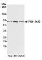 FAM114A2 / C5orf3 Antibody - Detection of human FAM114A2 by western blot. Samples: Whole cell lysate (15 µg) from HeLa, HEK293T, and Jurkat cells prepared using NETN lysis buffer. Antibody: Affinity purified rabbit anti-FAM114A2 antibody used for WB at 1:1000. Detection: Chemiluminescence with an exposure time of 75 seconds.