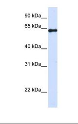 FAM116A Antibody - 293T cell lysate. Antibody concentration: 1.0 ug/ml. Gel concentration: 12%.  This image was taken for the unconjugated form of this product. Other forms have not been tested.