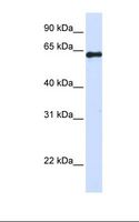 FAM116A Antibody - 293T cell lysate. Antibody concentration: 1.0 ug/ml. Gel concentration: 12%.  This image was taken for the unconjugated form of this product. Other forms have not been tested.