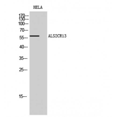 FAM117B / ALS2CR13 Antibody - Western blot of ALS2CR13 antibody