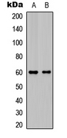 FAM117B / ALS2CR13 Antibody - Western blot analysis of ALS2CR13 expression in HepG2 (A); mouse brain (B) whole cell lysates.