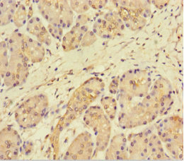 FAM117B / ALS2CR13 Antibody - Immunohistochemistry of paraffin-embedded human pancreatic tissue using FAM117B Antibody at dilution of 1:100