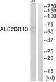 FAM117B / ALS2CR13 Antibody - Western blot analysis of extracts from Jurkat cells, using ALS2CR13 antibody.