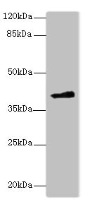 FAM118A Antibody - Western blot All lanes: FAM118A antibody at 4µg/ml + 293T whole cell lysate Secondary Goat polyclonal to rabbit IgG at 1/10000 dilution Predicted band size: 41, 20 kDa Observed band size: 41 kDa