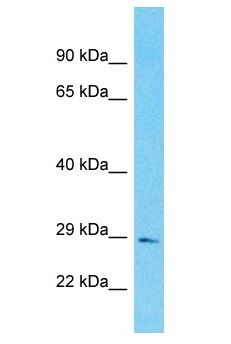 FAM118B Antibody - FAM118B antibody Western Blot of Fetal Lung. Antibody dilution: 1 ug/ml.  This image was taken for the unconjugated form of this product. Other forms have not been tested.