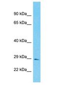 FAM118B Antibody - FAM118B antibody Western Blot of Fetal Lung. Antibody dilution: 1 ug/ml.  This image was taken for the unconjugated form of this product. Other forms have not been tested.