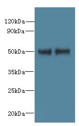 FAM118B Antibody - Western blot. All lanes: FAM118B antibody at 12 ug/ml. Lane 1: Jurkat whole cell lysate. Lane 2: U251 whole cell lysate. Secondary Goat polyclonal to Rabbit IgG at 1:10000 dilution. Predicted band size: 39 kDa. Observed band size: 39 kDa.