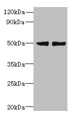 FAM118B Antibody - Western blot All lanes: FAM118B antibody at 12µg/ml Lane 1: Jurkat whole cell lysate Lane 2: U251 whole cell lysate Secondary Goat polyclonal to rabbit IgG at 1/10000 dilution Predicted band size: 39 kDa Observed band size: 39 kDa