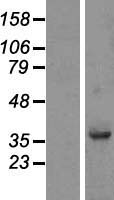 FAM118B Protein - Western validation with an anti-DDK antibody * L: Control HEK293 lysate R: Over-expression lysate