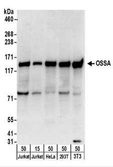 FAM120A Antibody - Detection of Human and Mouse OSSA by Western Blot. Samples: Whole cell lysate from Jurkat (15 and 50 ug), HeLa (50 ug), 293T (50 ug), and mouse NIH3T3 (50 ug) cells. Antibodies: Affinity purified rabbit anti-OSSA antibody used for WB at 1 ug/ml. Detection: Chemiluminescence with an exposure time of 10 seconds.