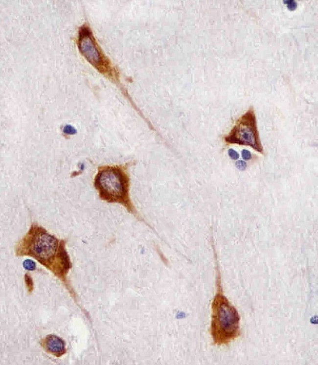 FAM120A Antibody - Antibody staining FAM120A in human brain sections by Immunohistochemistry (IHC-P - paraformaldehyde-fixed, paraffin-embedded sections). Tissue was fixed with formaldehyde and blocked with 3% BSA for 0. 5 hour at room temperature; antigen retrieval was by heat mediation with a citrate buffer (pH 6). Samples were incubated with primary antibody (1:25) for 1 hours at 37°C. A undiluted biotinylated goat polyvalent antibody was used as the secondary antibody.