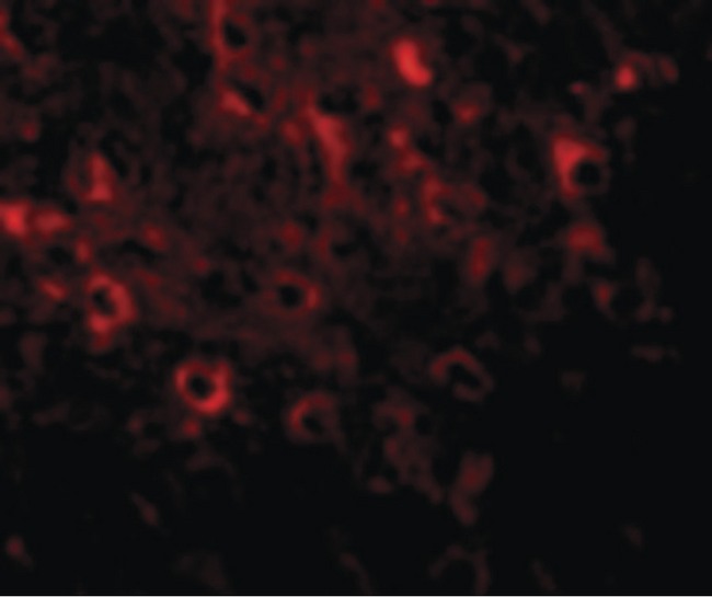 FAM120A Antibody - Immunofluorescence of FAM120A in Rat Brain cells with FAM120A antibody at 20 ug/ml.