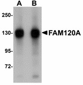 FAM120A Antibody - Western blot of FAM120A in SK-N-SH cell lysate with FAM120A antibody at (A) 0.5 and (B) 1 ug/ml. Below: Immunohistochemistry of FAM120A in rat brain tissue with FAM120A antibody at 2.5 ug/ml.
