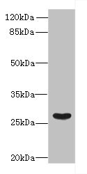 FAM122B Antibody - Western blot All lanes: FAM122B antibody at 5µg/ml + Mouse brain tissue Secondary Goat polyclonal to rabbit IgG at 1/10000 dilution Predicted band size: 27, 28, 30, 20 kDa Observed band size: 27 kDa