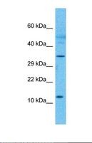 FAM122C Antibody - Western blot of Human Pancreas Tumor. RP3-473B4.1 antibody dilution 1.0 ug/ml.  This image was taken for the unconjugated form of this product. Other forms have not been tested.