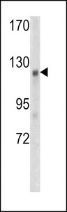 FAM123B / WTX Antibody - Western blot of WTX antibody in mouse kidney tissue lysates (35 ug/lane). WTX (arrow) was detected using the purified antibody.