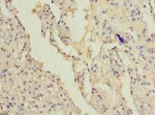 FAM124B Antibody - Immunohistochemistry of paraffin-embedded human lung using antibody at dilution of 1:100.