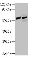 FAM124B Antibody - Western blot All lanes: FAM124B antibody at 12µg/ml Lane 1: Hela whole cell lysate Lane 2: K562 whole cell lysate Secondary Goat polyclonal to rabbit IgG at 1/10000 dilution Predicted band size: 51, 32 kDa Observed band size: 51 kDa