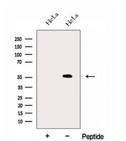 FAM124B Antibody - Western blot analysis of extracts of HeLa cells using FAM124B antibody. The lane on the left was treated with blocking peptide.