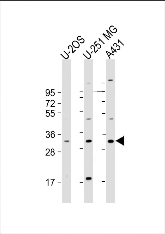 FAM125A Antibody - All lanes: Anti-FAM125A Antibody (Center) at 1:2000 dilution Lane 1: U-2OS whole cell lysate Lane 2: U-251 MG whole cell lysate Lane 3: A431 whole cell lysate Lysates/proteins at 20 µg per lane. Secondary Goat Anti-Rabbit IgG, (H+L), Peroxidase conjugated at 1/10000 dilution. Predicted band size: 29 kDa Blocking/Dilution buffer: 5% NFDM/TBST.