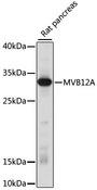 FAM125A Antibody - Western blot analysis of extracts of rat pancreas using MVB12A Polyclonal Antibody at dilution of 1:1000.