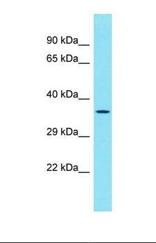 FAM125B Antibody - Western blot of Human MDA-MB-435S. MVB12B antibody dilution 1.0 ug/ml.  This image was taken for the unconjugated form of this product. Other forms have not been tested.