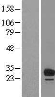 FAM125B Protein - Western validation with an anti-DDK antibody * L: Control HEK293 lysate R: Over-expression lysate