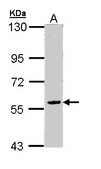 FAM126A / HCC Antibody - Sample (30 ug of whole cell lysate). A: Raji. 7.5% SDS PAGE. FAM126A / HCC antibody diluted at 1:10000