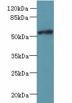 FAM126B Antibody - Western blot. All lanes: FAM126B antibody at 7 ug/ml+ A431 whole cell lysate Goat polyclonal to rabbit at 1:10000 dilution. Predicted band size: 59 kDa. Observed band size: 59 kDa.