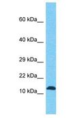 FAM127B Antibody - FAM127B antibody Western Blot of MDA-MB-435s. Antibody dilution: 1 ug/ml.  This image was taken for the unconjugated form of this product. Other forms have not been tested.