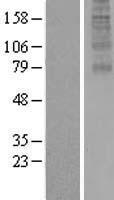 FAM127B Protein - Western validation with an anti-DDK antibody * L: Control HEK293 lysate R: Over-expression lysate