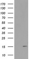 FAM127C Antibody - HEK293T cells were transfected with the pCMV6-ENTRY control (Left lane) or pCMV6-ENTRY FAM127C (Right lane) cDNA for 48 hrs and lysed. Equivalent amounts of cell lysates (5 ug per lane) were separated by SDS-PAGE and immunoblotted with anti-FAM127C.